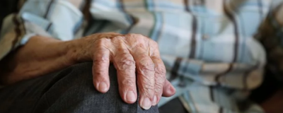 怎么預防老年斑