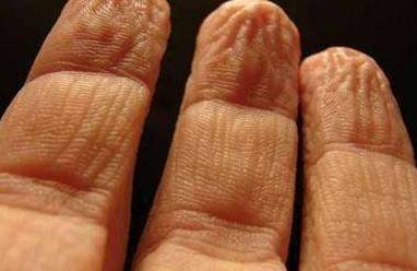 0010378011311 手洗了水起皺紋怎么辦