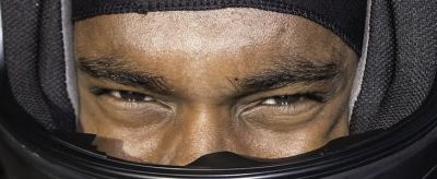 0024295911310 皮膚發黃是什么原因