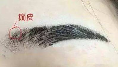 紋眉掉痂可以撕嗎