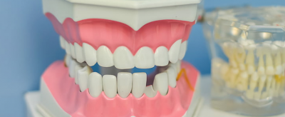 0052414211310 美白牙齒的方法