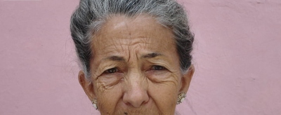 臉部松弛下垂怎么辦