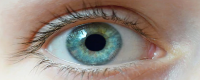 怎么消除眼角皺紋