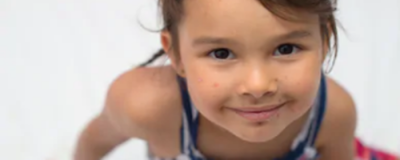 臉頰長痘痘怎么回事