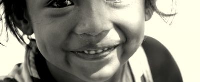 0206417211310 怎么去除法令紋