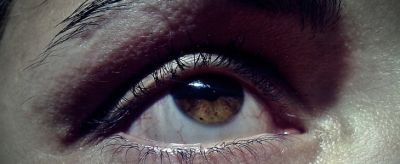 0218052011310 眼皮松弛了怎么辦