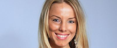 怎么改善膚色暗沉