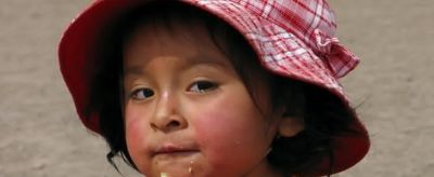 0232512211310 怎么去紅血絲