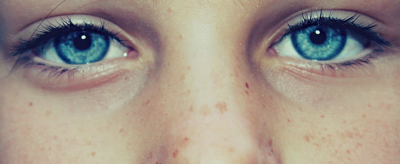 黃褐斑怎么回事