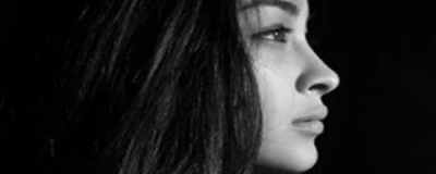 0801395311308 如何使鼻梁增高