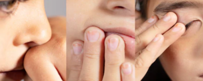 0801459311308 如何使鼻梁增高