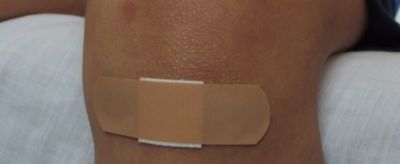 0906096911310 脫皮怎么辦