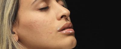 臉上長痘痘了怎么辦