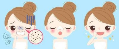 夏天怎么護膚不長痘