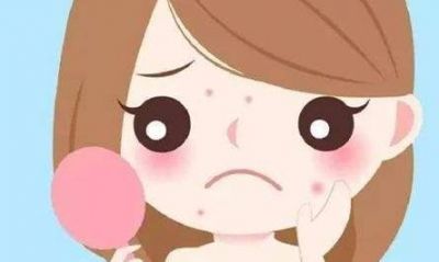 預防痘印有什么有效方法