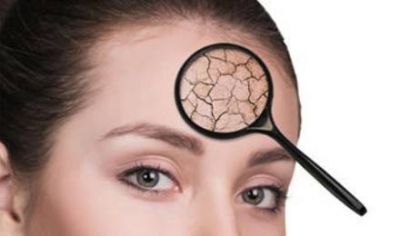 0923574311311 額頭皮膚特別粗糙怎么辦