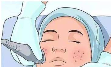 微針收縮毛孔效果怎樣