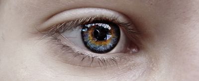 0952322011310 眼下皺紋怎么消除