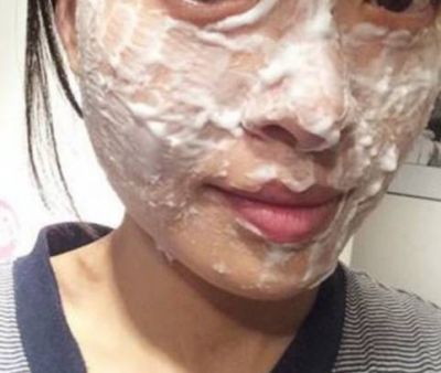 阿莫西林真的可以去黑頭嗎