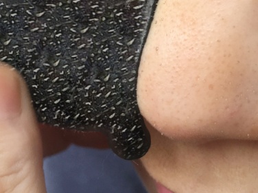 0959113311311 蘇打粉能去黑頭是真的嗎