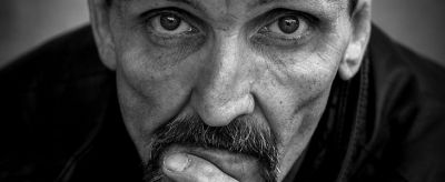 法令紋怎么去除