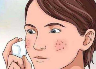 1047204111311 青春期最簡單的收縮毛孔方法