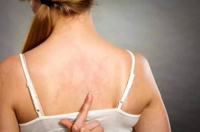 背上長了很多痘痘怎么辦