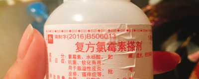 1133512311308 長粉刺的原因有哪些