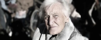 手上的老年斑怎樣去掉