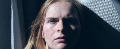 1205082911310 臉上長痤瘡怎么辦