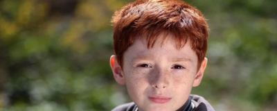 頭發稀疏怎么辦