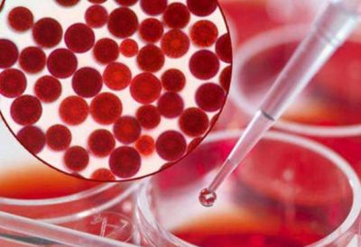 1236187011311 蝦青素涂臉后色素沉著怎么辦