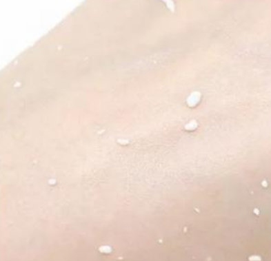 擠完粉刺痘痘可以敷面膜嗎