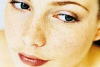 藏紅花怎么淡斑