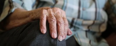 黃褐斑是什么原因引起的