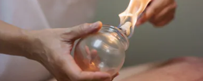 1430249111308 拔罐減肥反彈嗎