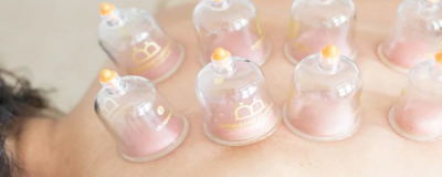 1430268611308 拔罐減肥反彈嗎