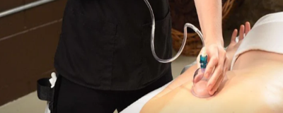 1430287711308 拔罐減肥反彈嗎