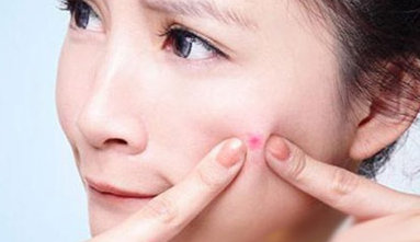 臉頰兩邊老是長痘痘是怎么回事