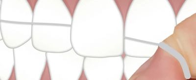 1458145211310 如何使用牙線