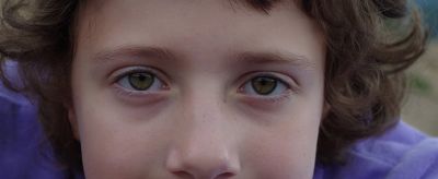 黃褐斑能自己消退嗎