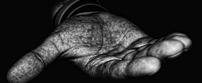 手上皮膚粗糙怎么辦