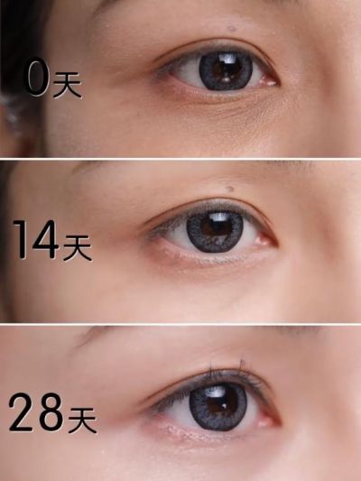 仁和眼霜真的能去黑眼圈嗎