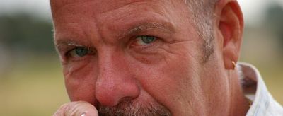 額頭皺紋怎么去除