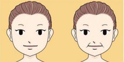 1548492711311 玻尿酸填充法令紋有硬塊多久能消除