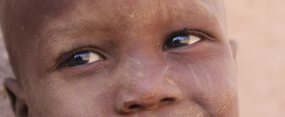 皮膚干燥起皮怎么辦