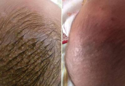 橄欖油去頭垢正確方法是怎么樣的