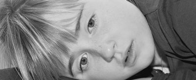 怎樣可以淡化雀斑