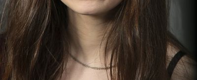 頸紋很深怎么辦