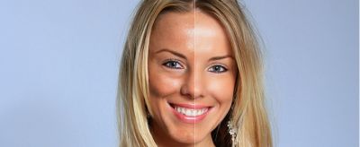 膚色暗沉是什么原因